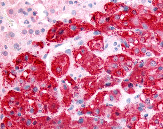 IHC - SPHK / SPHK1 Antibody (N-Terminus) ALS10625